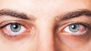 6 Këshilla si të Përmirësoni Shikimin e Mprehtë dhe Shëndetin e Syve