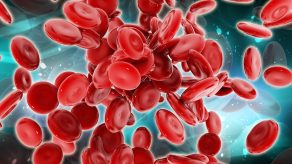 Hemoglobina për shëndetin – Mënyrat natyrale për të rritur nivelet e saj