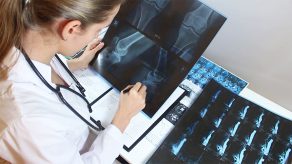 Tri Shenjat Paralajmëruese të Osteoporozës që Duhet t'i Dini Patjetër