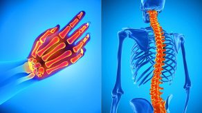 Pse Terapia Manuale është e Rëndësishme për Personat me Artrit